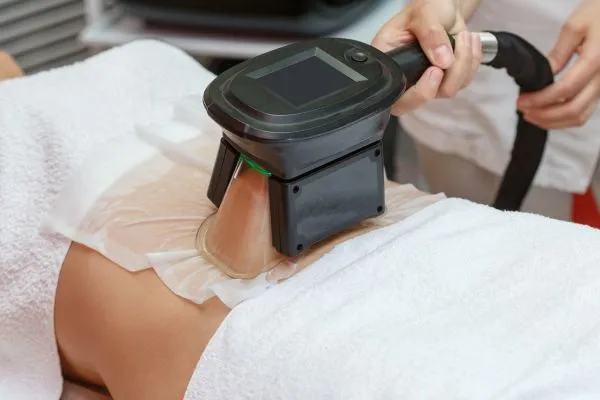 Image of person having fat freezing treatment to help weight gain Bury St Edmunds